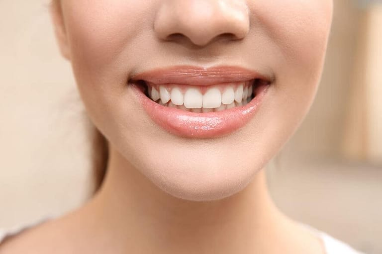 Gummy Smile